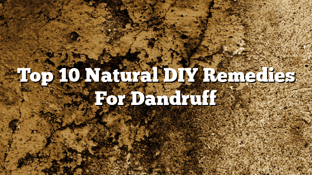 Top 10 Natural DIY Remedies For Dandruff