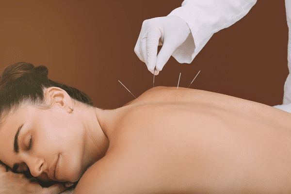 10 Proven Benefits Of Acupuncture: Dive Deep Into Holistic Health